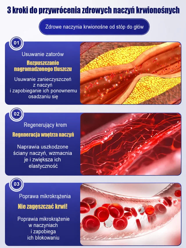 Skuteczny krem na żylaki