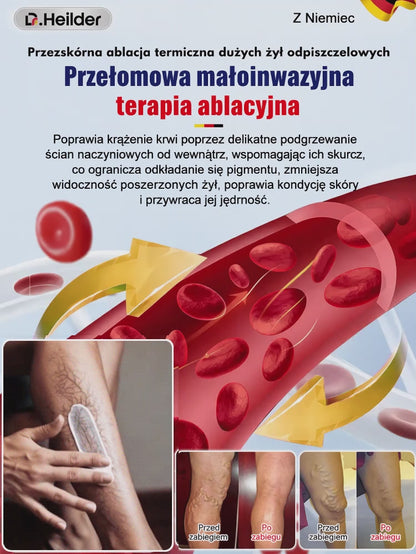 Skuteczny krem na żylaki